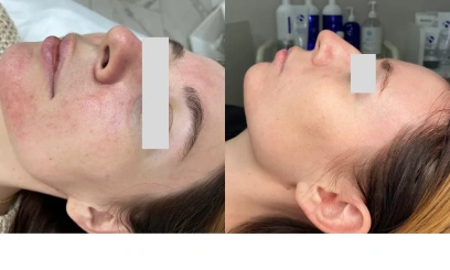 Уход Anti-Age "Defense" от  PHYTO-C Уход Anti-Age "Defense" от  PHYTO-C